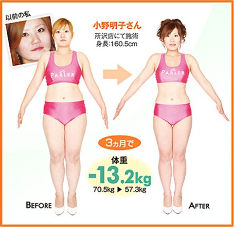 ���얾�q���� ����X�ɂĎ{�p�@�g���F160.5cm�@3������ �̏d-13.2kg