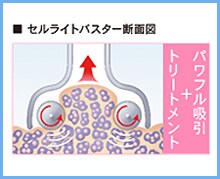 �Z�����C�g�o�X�^�[�f�ʐ} �p���t���z��+�g���[�g�����g