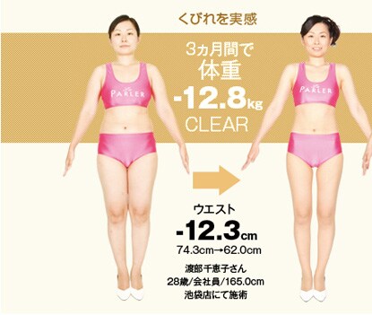 ウエスト-12.3cm 74.3cm→62.0cm 渡部千恵子さん 28歳/会社員/165.0cm 池袋店にて施術