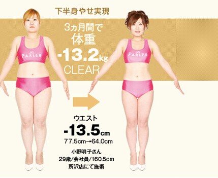 ウエスト-13.5cm 77.5cm→64.0cm 小野明子さん 29歳/会社員/160.5cm 所沢店にて施術