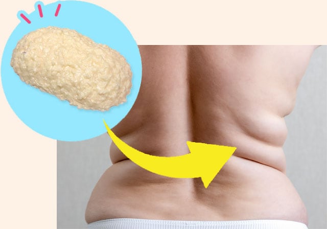 一度溜まってしまったセルライトはなかなか落ちません。