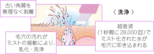 「洗浄」 古い角質を無理なく剥離 毛穴の汚れがミストの振動により、乳化・洗浄 超音波（1秒間に28,000回）でミスト化された水が毛穴に叩き込まれる