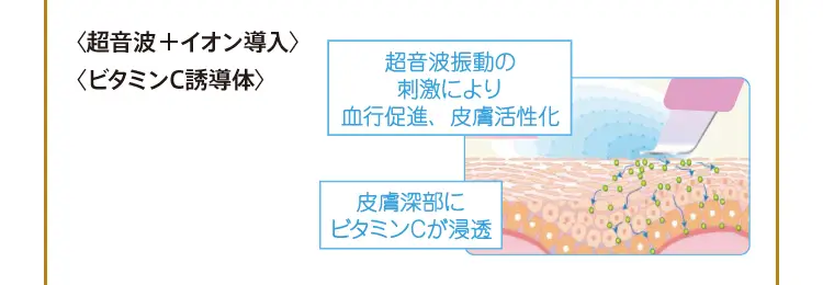 「超音波＋イオン導入」「ビタミンC誘導体」 超音波振動の刺激により血行促進、皮膚活性化 皮膚深部にビタミンCga浸透