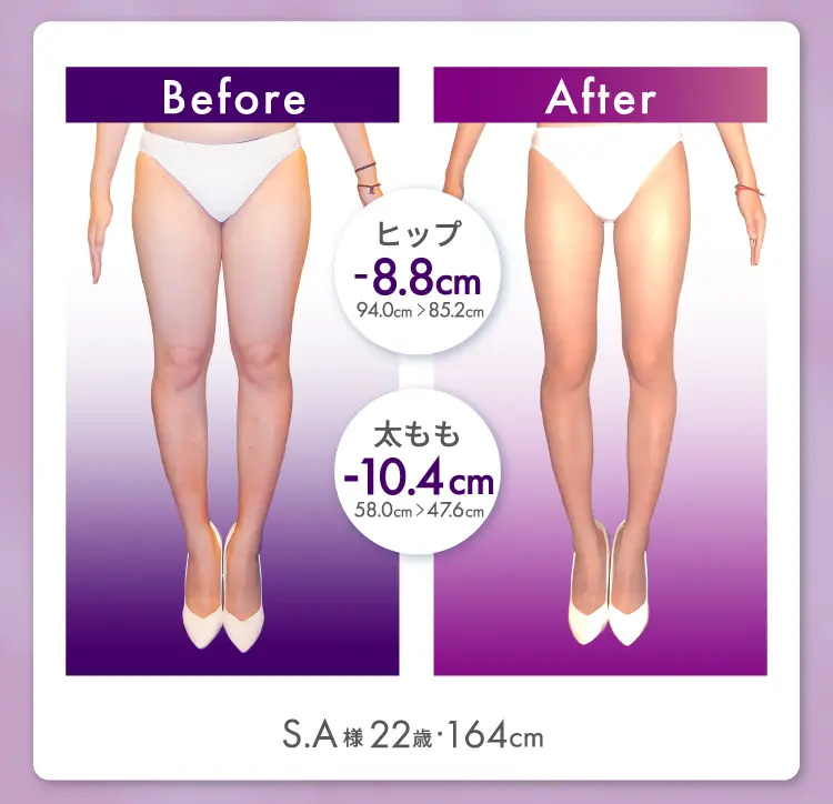 S.A様 22歳 164cm Before After