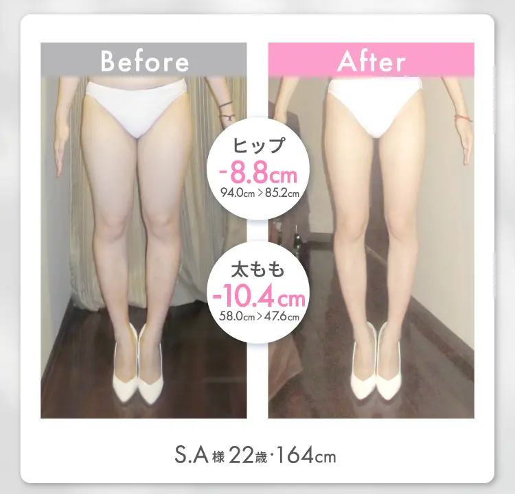 S.A様 22歳 164cm Before After