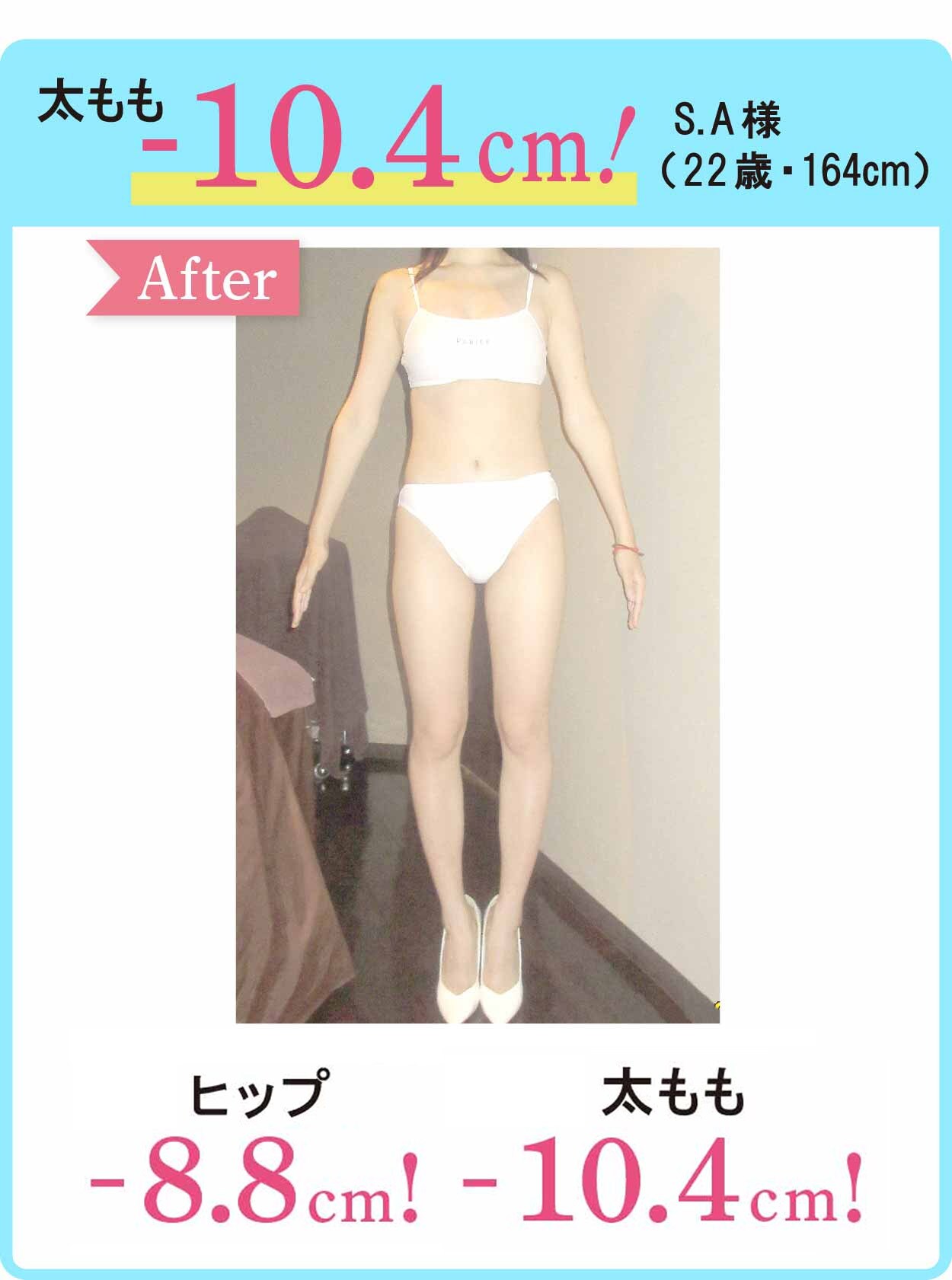 太もも -10.4cm！ S.A様（22歳・164cm） After ヒップ -8.8cm！ 太もも -10.4cm！