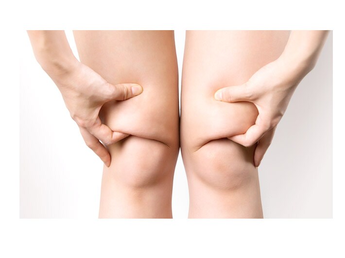 頑固なセルライト、皮下脂肪、老廃物など原因はたくさん！