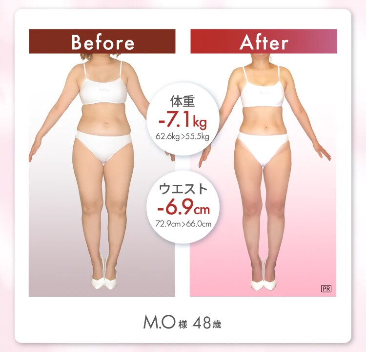 M.O様 48歳 Before After 体重7.1kg減 ウエスト6.9cm減