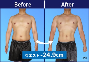 Before After 例 ウエスト マイナス24.9cm！