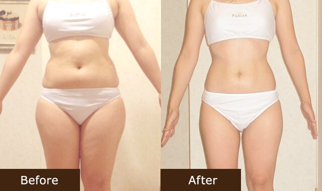 ビフォア＆アフター N.M様(27歳)