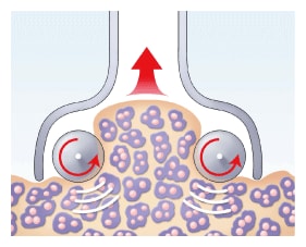 頑固なセルライトをもみ上げる！
