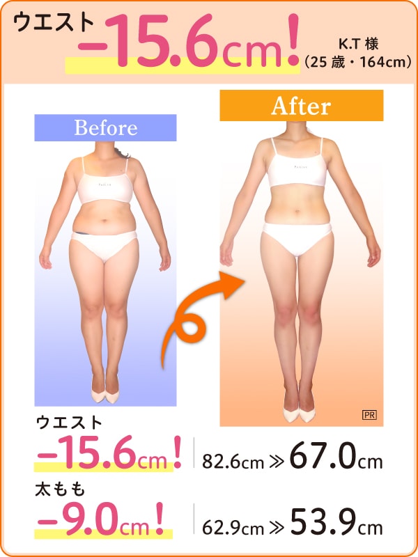 ウエスト -15.6cm！ K.T様（25歳・164cm）Before-After ウエスト -15.6cm！ 82.6cm → 67.0cm 太もも -9.0cm！ 62.9cm → 53.9cm