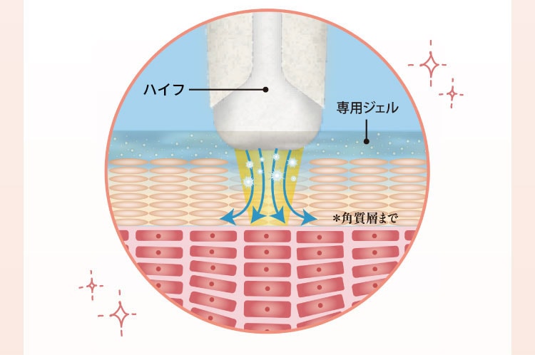 小顔BHF機器の作用イメージ