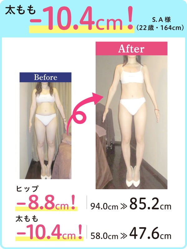 太もも -10.4cm！ S.A様（22歳・164cm） Before-After ヒップ -8.8cm！ 94.0cm → 85.2cm 太もも -10.4cm！ 58.0cm → 47.6cm