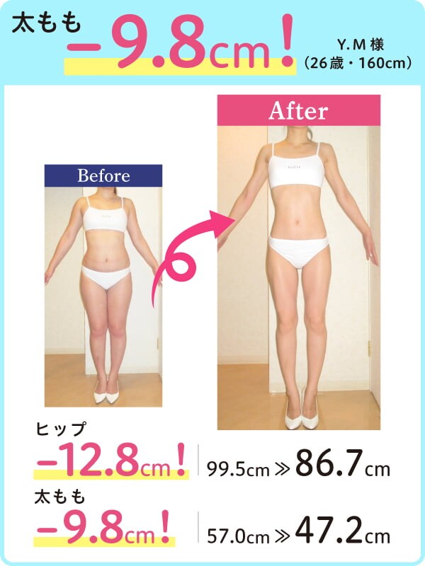 太もも -9.8cm！ Y.M様（26歳・160cm） Before-After ヒップ -12.8cm！ 99.5cm → 86.7cm 太もも -9.8cm！ 57.0cm → 47.2cm