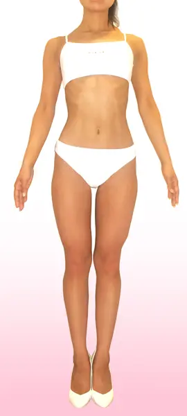 29歳　I.Y様 after写真