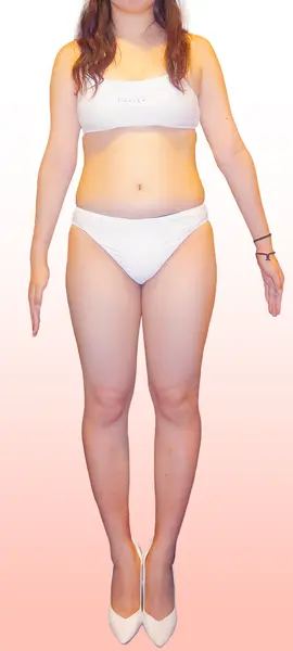 22歳　S.A様 before写真