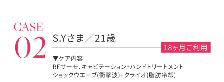CASE02 S.Yさま / 21歳 18か月ご利用 ケア内容：RFサーモ、キャビテーション＋ハンドトリートメント、ショックウェーブ（衝撃波）＋クライオ（脂肪冷却）