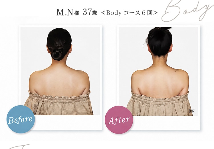 Body M.N様 37歳 Before After Bodyコース6回！天使の羽根もしっかり見える状態に PR