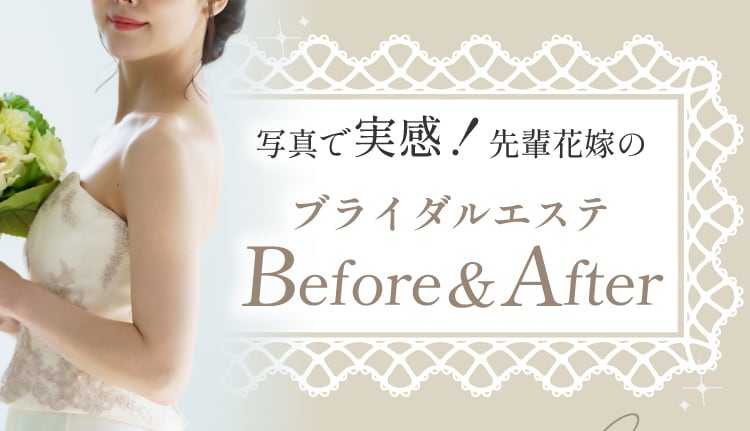 写真て実感！先輩花嫁のプライダルエステ Before After
