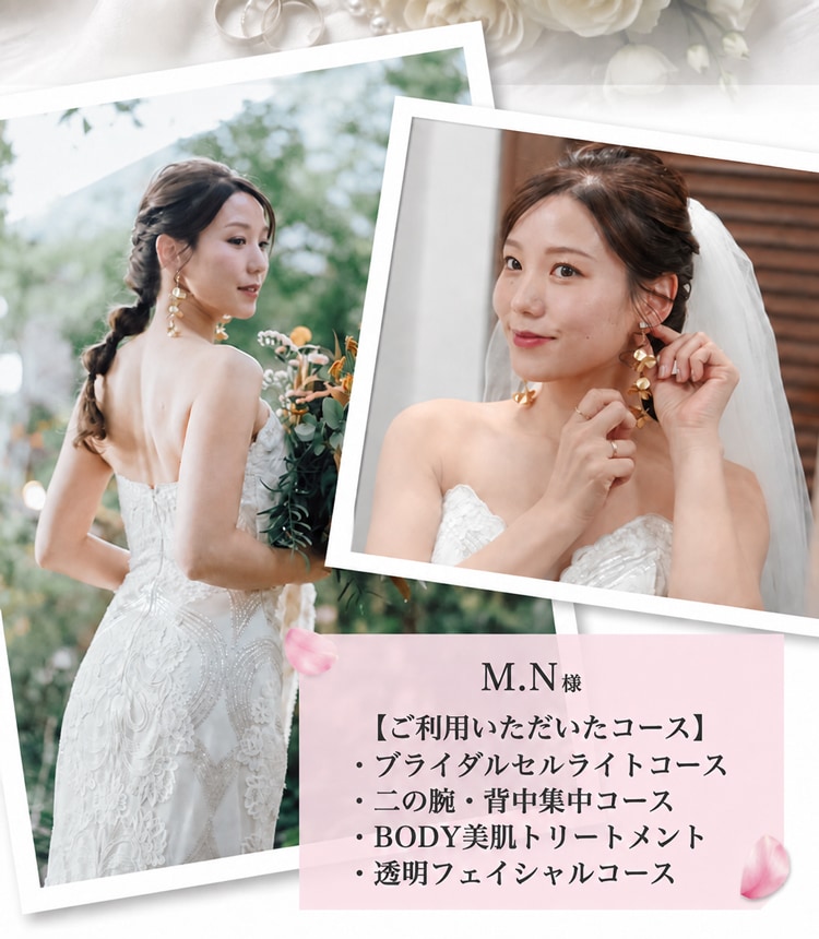 M.N様【ご利用いただいたコース】・ブライダルセルライトコース 二の腕・背中集中コース・BODY 美肌トリートメント・透明フェイシャルコース