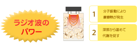 ラジオ波のパワー 1.分子振動により摩擦熱が発生 2.深部から温めて