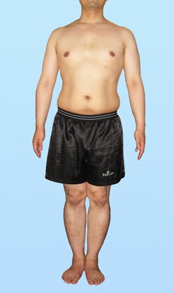 D.W 様 ビフォー画像