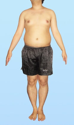 S.S 様 様 ビフォー画像