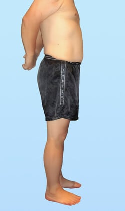 K.K 様 アフター画像