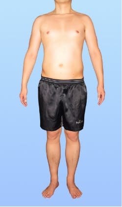 K.O 様 ビフォー画像