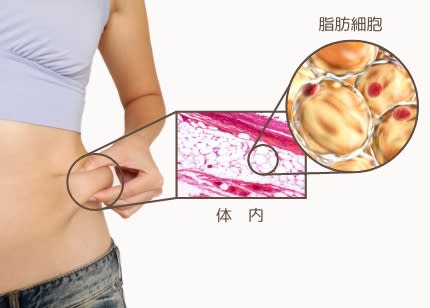 理想のボディに近づけない、カラダの不調など症状につながる可能性のイメージ