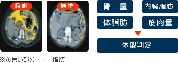 骨量、内臓脂肪、体脂肪、筋肉量　→　体型判定