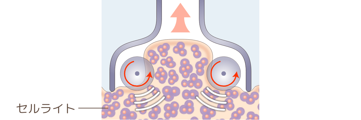 吸引とローラー機能付き専用マシンを使用したトリートメント