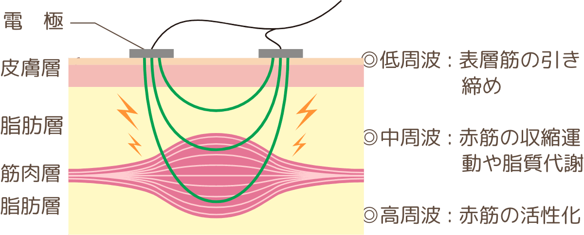 筋肉運動で引き締め＆代謝をアップ