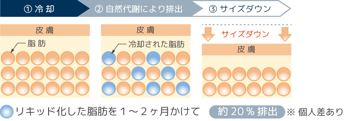 筋肉運動で引き締め＆代謝をアップ