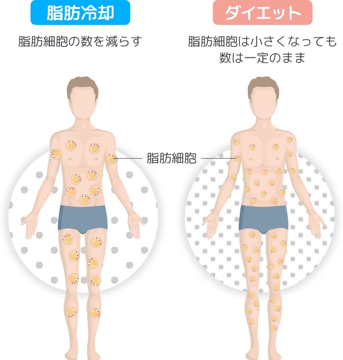 脂肪冷却とダイエットの効果のイメージ