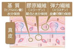ラジオ波