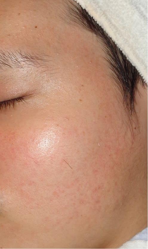 H.K 様 アフター画像