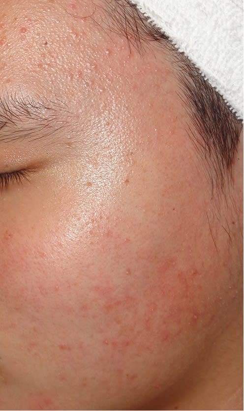 H.K 様 ビフォー画像