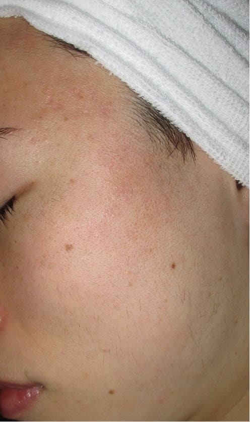 S.T 様 アフター画像