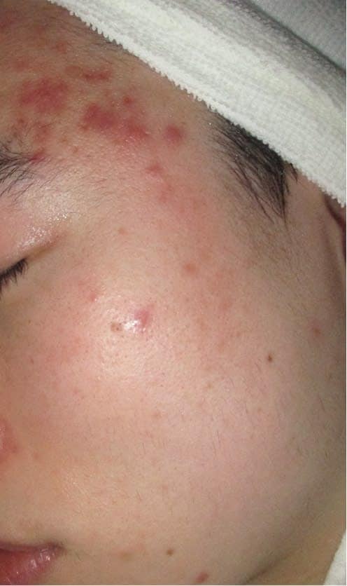 S.T 様 ビフォー画像