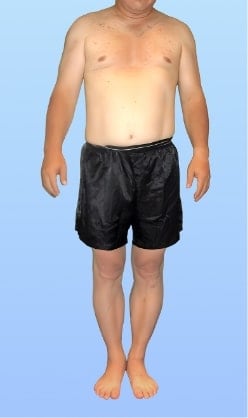 S.Y 様 アフター画像