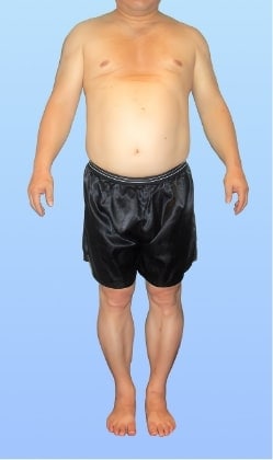 S.Y 様 ビフォー画像