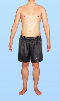 S.Y 様 アフター画像