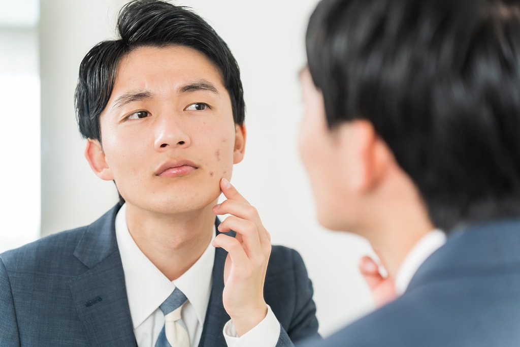 大人だってニキビに悩む！原因をしらないといつまでたっても治らない！？