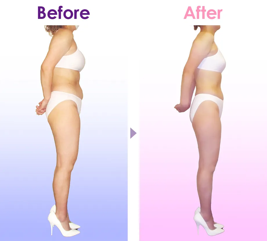 Before After イメージ2