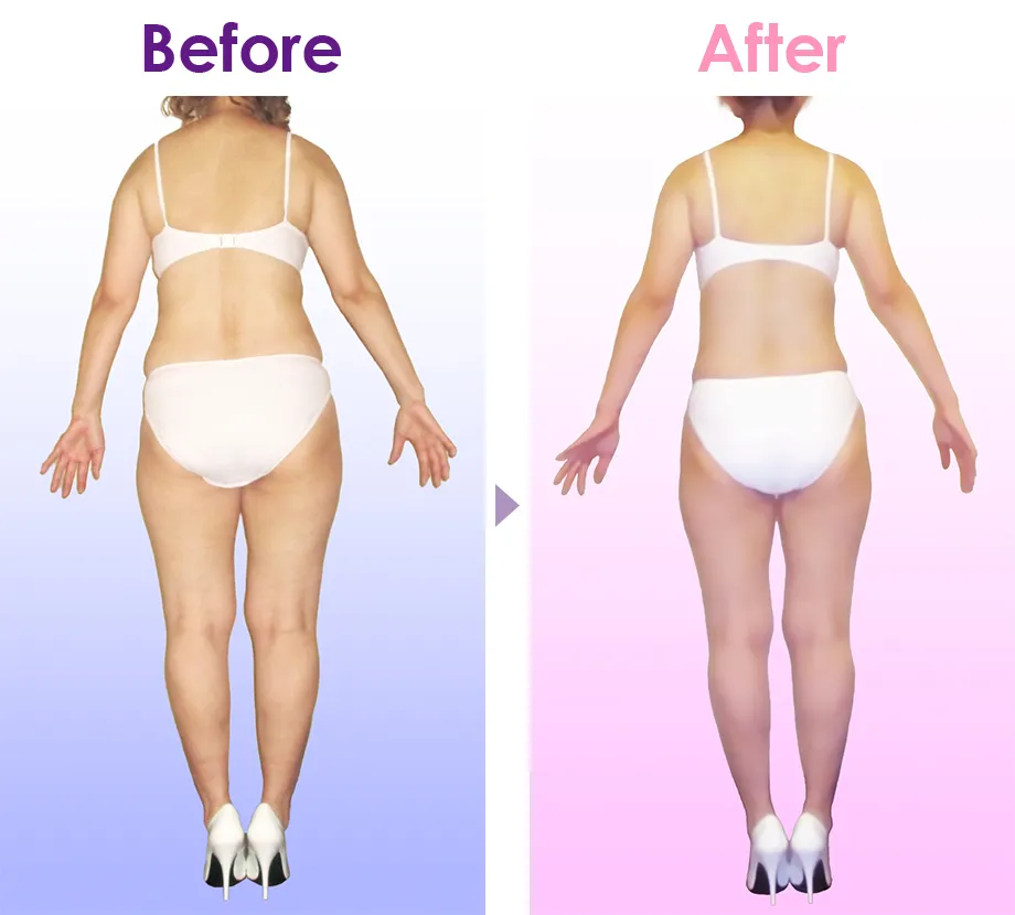 Before After イメージ3