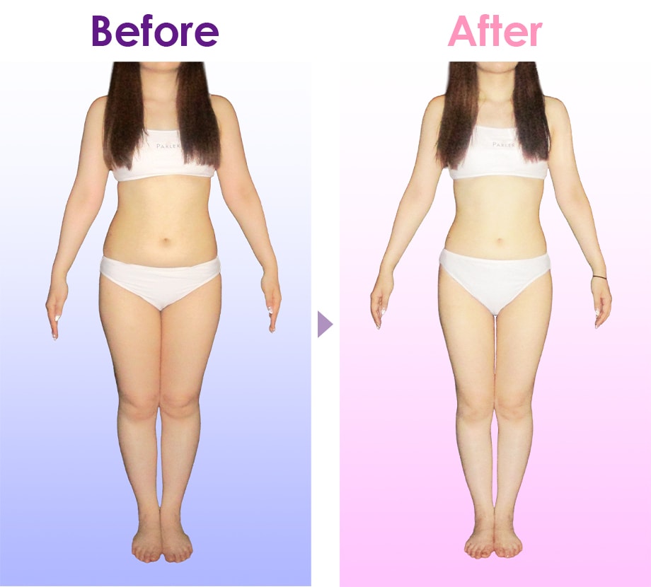 Before After イメージ1