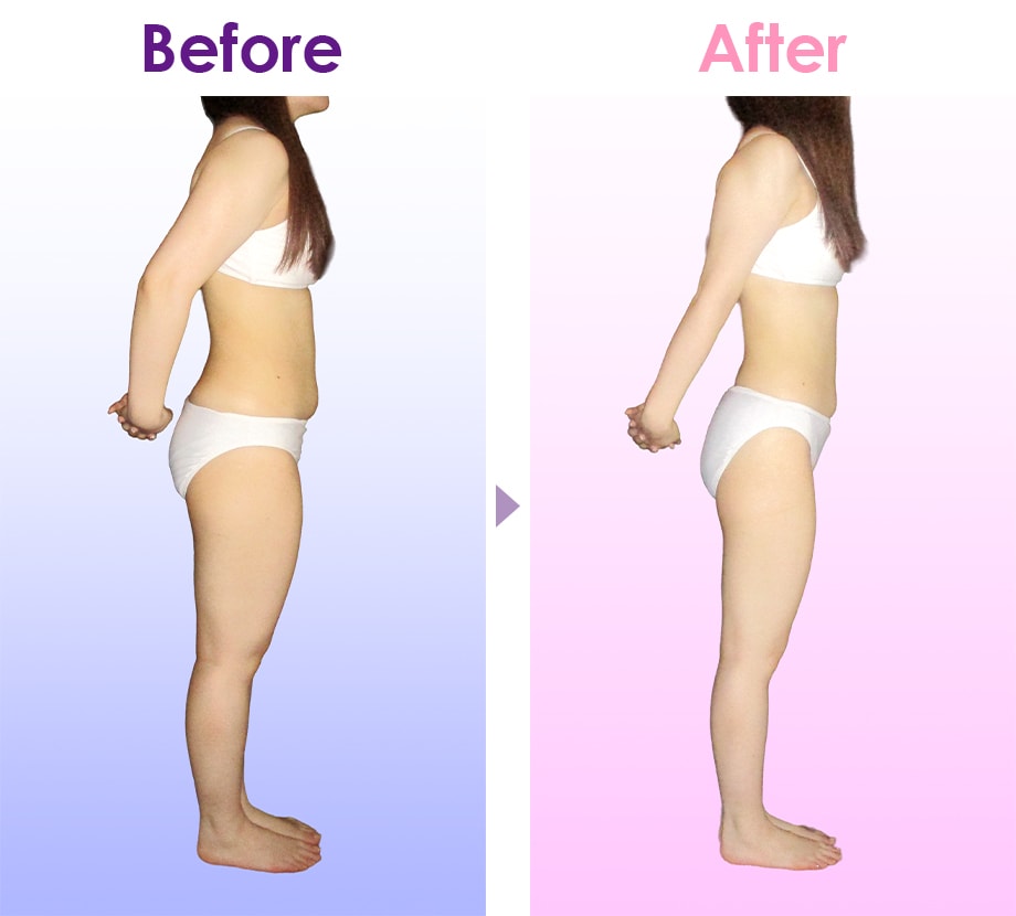 Before After イメージ2