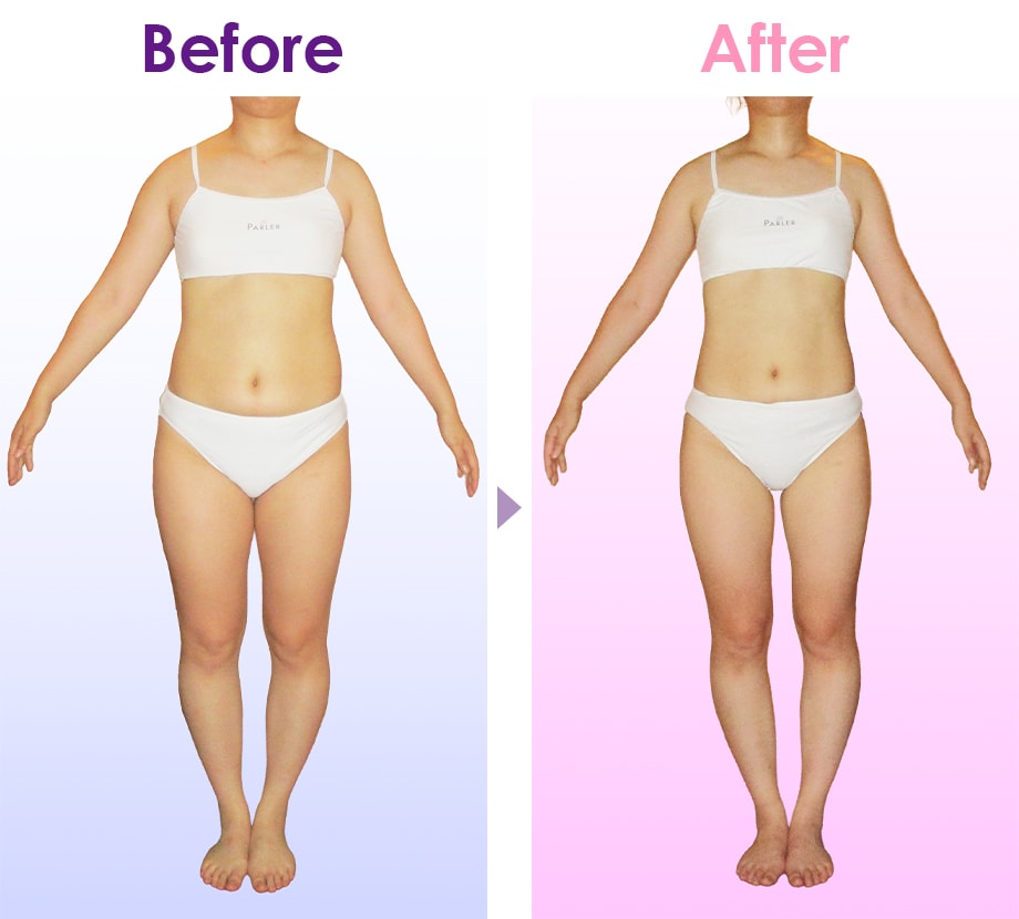 Before After イメージ1